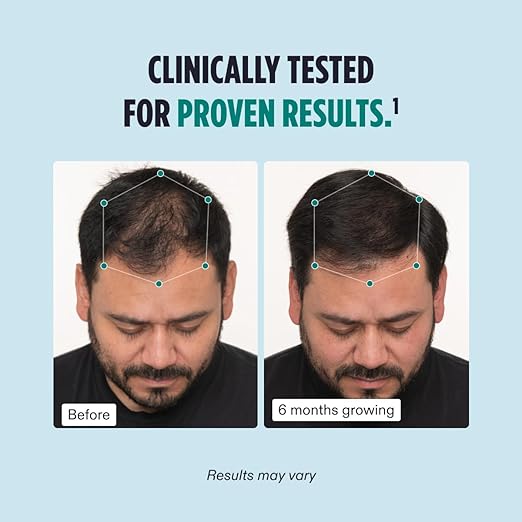 Nutrafol Men's Hair Growth Supplements - Clinically Tested for Thicker Hair & Scalp Coverage 1-Month Supply